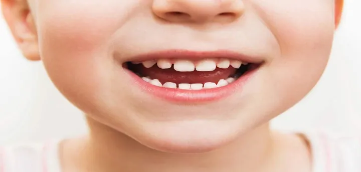 Cara Merawat Gigi Pada Anak