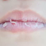 Tips Agar Bibir Tidak Mudah Kering