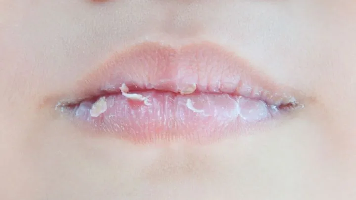 Tips Agar Bibir Tidak Mudah Kering